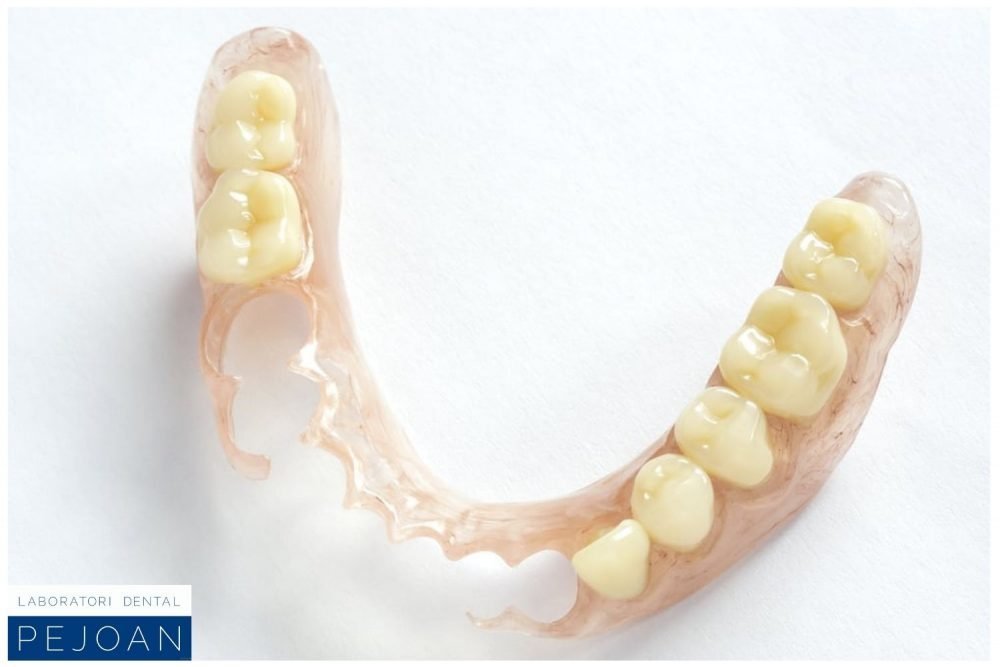 Prótesis removible parcial