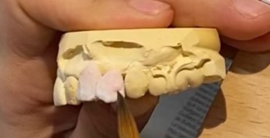 Preparando cerámica Dental lab pejoan