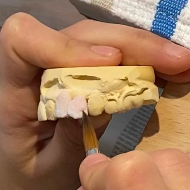 Preparando cerámica Dental lab pejoan