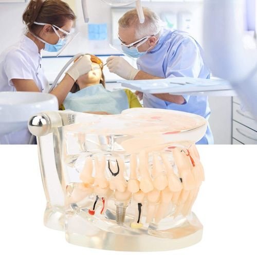 tips laboratorio Prótesis Dental