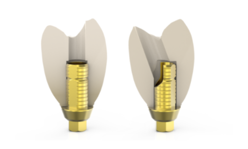 base titanio recta angulada base titanio recta angulada