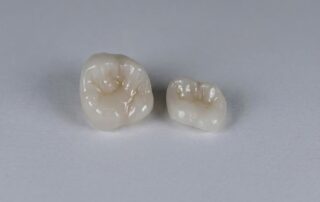 incrustación disilicato