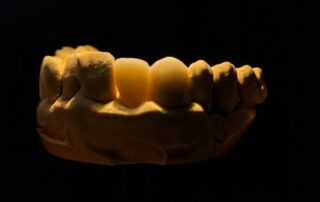 Laboratorio Dental de Prótesis Fijas